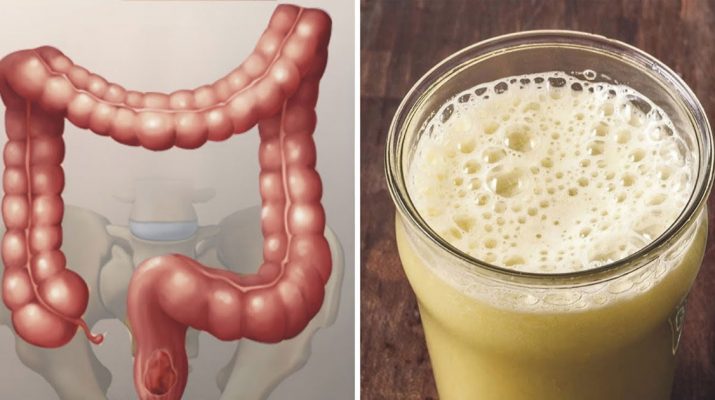How-To-Remove-Pounds-Of-Waste-From-Your-Colon-In-2-Weeks