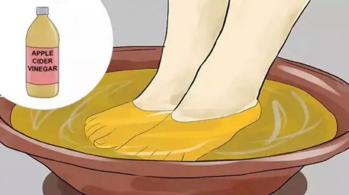 Once-A-Week-Soak-The-Feet-In-Vinegar,-And-You-Are-Going-To-Heal-Yourself-From-Many-Diseases