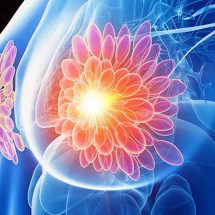 Researchers Treat HER2-Positive Breast Cancer Without Chemo