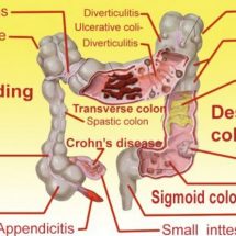 The Ginger, Apple and Lemon Flushes Pounds and Toxins