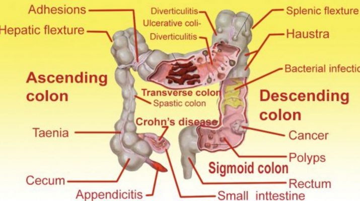 The-Ginger,-Apple-and-Lemon-Flushes-Pounds-and-Toxins