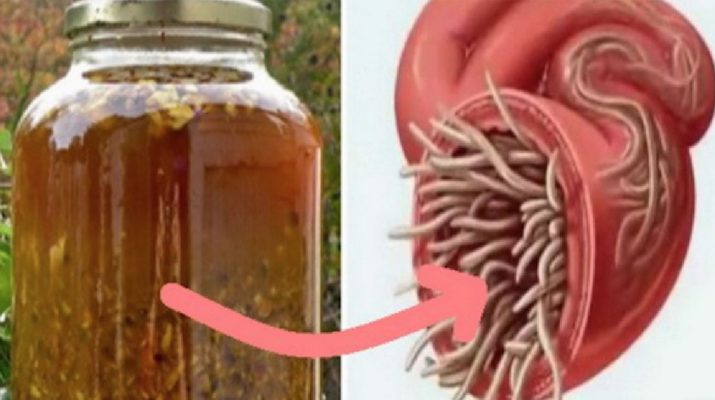 The-Most-Powerful-Natural-Antibiotic-Ever,-It-Cures-Any-Infection-In-The-Body-And-Kills-Parasites!
