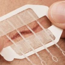 ZipStitch Is A New Way To Close Wounds When You’re Out There And Can’t Get To Help