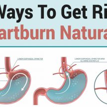 12 Ways To Get Rid Of Heartburn Naturally