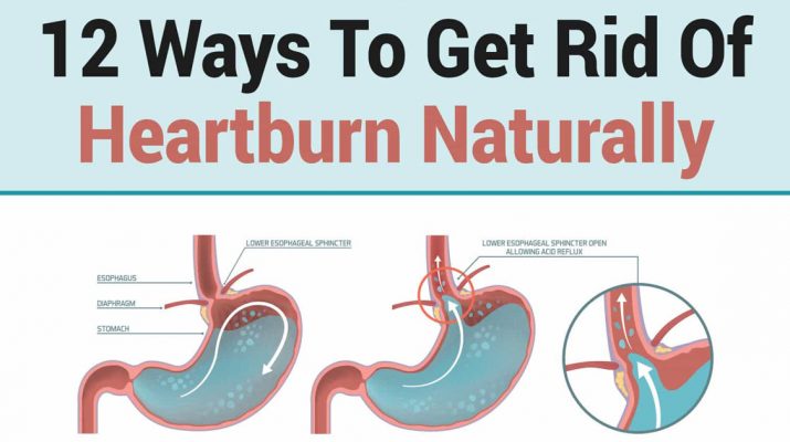 12-Ways-To-Get-Rid-Of-Heartburn-Naturally