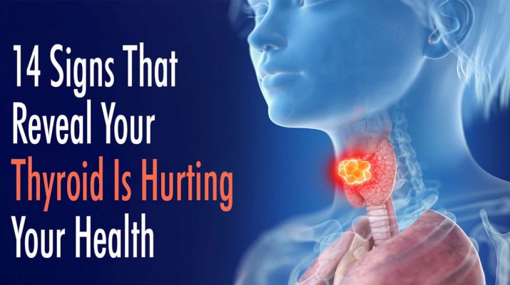 14-Signs-That-Reveal-Your-Thyroid-Is-Hurting-Your-Health