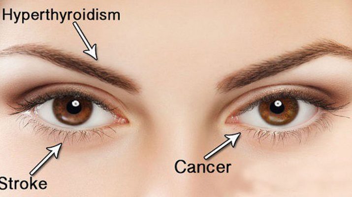 14-Things-Your-Eyes-are-Trying-to-Tell-You-About-Your-Health