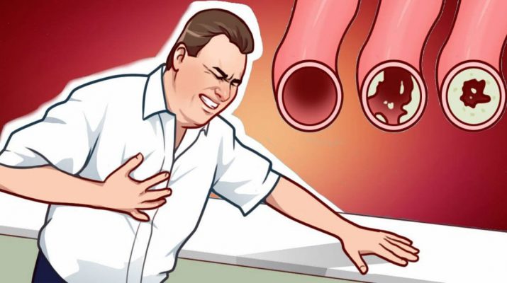 20-Foods-That-Will-Clean-Your-Arteries-Naturally-And-Protect-You-From-Heart-Attacks
