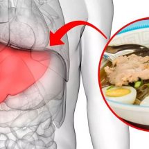 Choline Deficiency Can Trigger Fatty Liver Disease