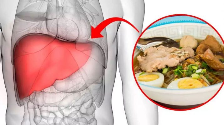 Choline-Deficiency-Can-Trigger-Fatty-Liver-Disease