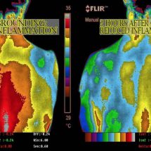 How To Reduce Inflammation In Your Body, Re-Energize, And Improve Your Blood Pressure At Zero Cost