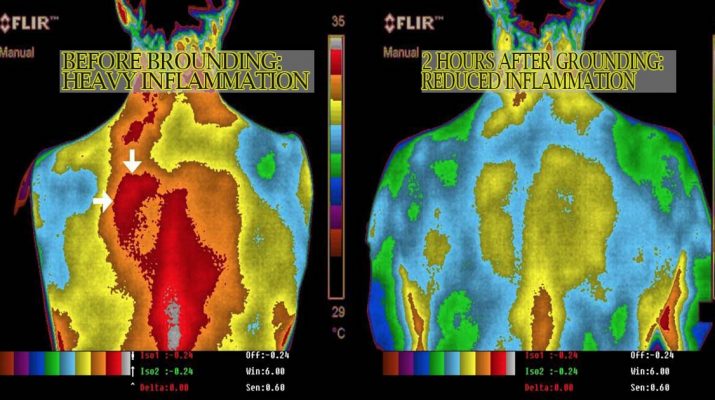 How-To-Reduce-Inflammation-In-Your-Body,-Re-Energize,-And-Improve-Your-Blood-Pressure-At-Zero-Cost