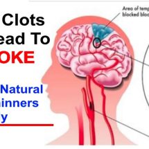 Natural Blood Thinners: Proven Foods, Supplements and Vitamins to Thin Blood (Evidence Based)