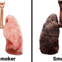 Nurse Explains What Smoking Every Day Does To Your Lungs