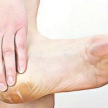 White Vinegar and Onion: The Most Effective Remedy for Feet Calluses