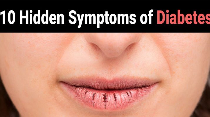 10-Hidden-Symptoms-of-Diabetes