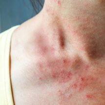 10 Things Itchy Skin Says About Your Health