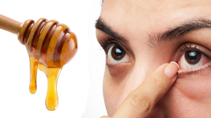 10-Ways-to-Relieve-Eye-Pain-Naturally
