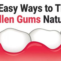 12 Easy Ways to Treat Swollen Gums Naturally