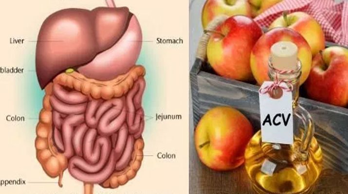 16-Proven-Health-Benefits-of-Apple-Cider-Vinegar-and-Honey-(Evidence-Based)