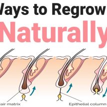 30 Ways to Regrow Hair Naturally