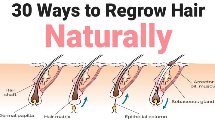 30-Ways-to-Regrow-Hair-Naturally