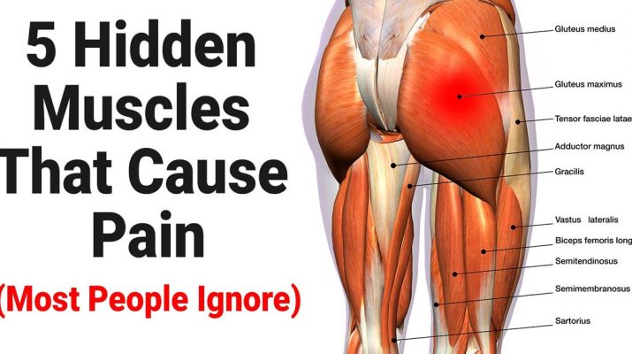 5-Hidden-Muscles-That-Cause-Pain-(Most-People-Ignore)