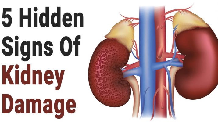5-Hidden-Signs-of-Kidney-Damage