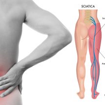 8 Sciatica Stretches to Help Prevent and Relieve Hip and Lower Back Pain