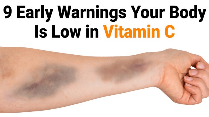 9-Early-Warnings-Your-Body-Is-Low-in-Vitamin-C