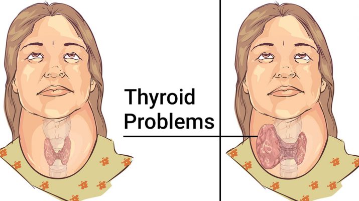 According-To-Science-These-11-Foods-Can-Heal-Your-Thyroid
