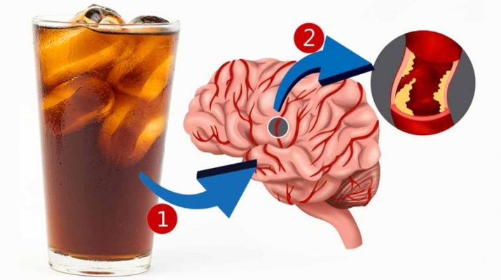 Artificially-Sweetened-Drinks-(Aspartame-etc.)-Found-To-Triple-Your-Risk-Of-Stroke-&-Dementia