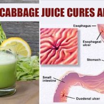 How To Make Cabbage Juice For Healing Stomach Ulcers And Open Sores