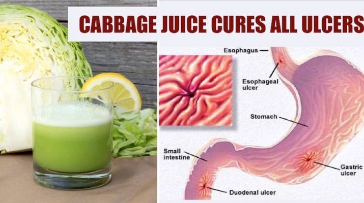 How-To-Make-Cabbage-Juice-For-Healing-Stomach-Ulcers-And-Open-Sores