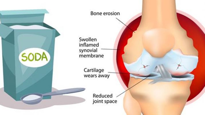 How-to-Use-Baking-Soda-To-Relieve-Arthritis-Pain