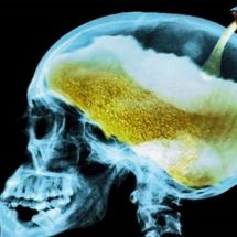 What Alcohol Consumption Does to Your Brain