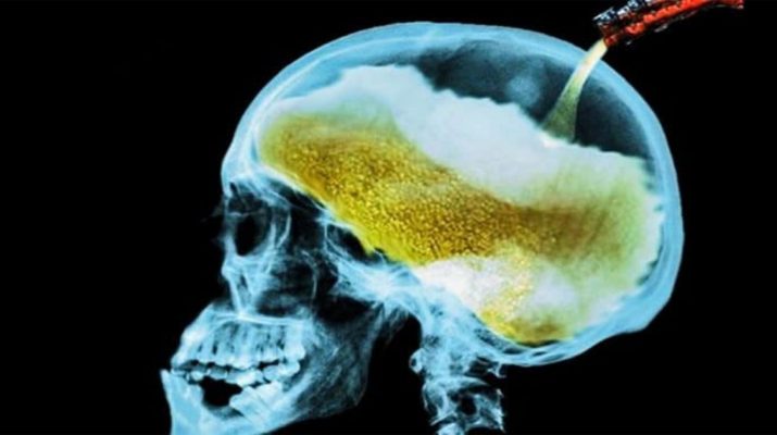What-Alcohol-Consumption-Does-to-Your-Brain