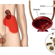 You Need A Kidney Cleanse. Here’s How To Flush Out Toxins From Your Kidneys