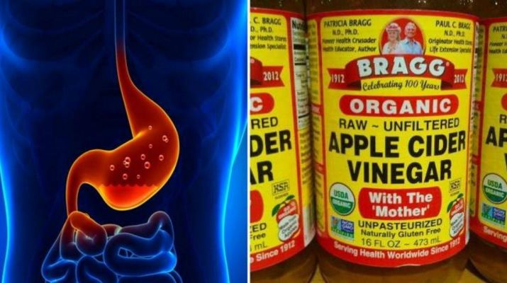 1-TBSP-of-Apple-Cider-Vinegar-For-60-Days-Can-Help-Eliminate-These-Health-Problems-(And-How-to-Use-it-Around-Your-Home)