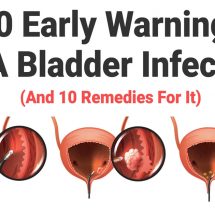 10 Early Warnings of A Bladder Infection (And 10 Remedies For It)