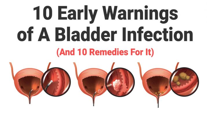 10-Early-Warnings-of-A-Bladder-Infection-(And-10-Remedies-For-It)