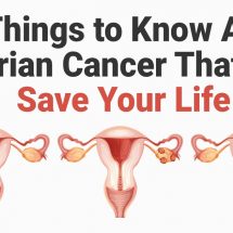 10 Things to Know About Ovarian Cancer That Can Save Your Life