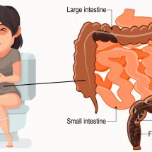 20 Foods That Relieve Constipation