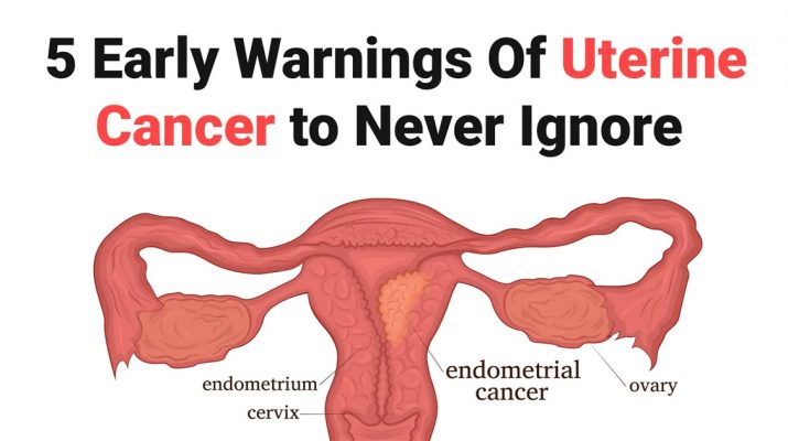 5-Early-Warnings-Of-Uterine-Cancer-to-Never-Ignore