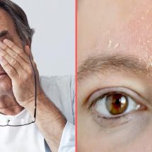 5 Hidden Signs You Are Vitamin Deficient