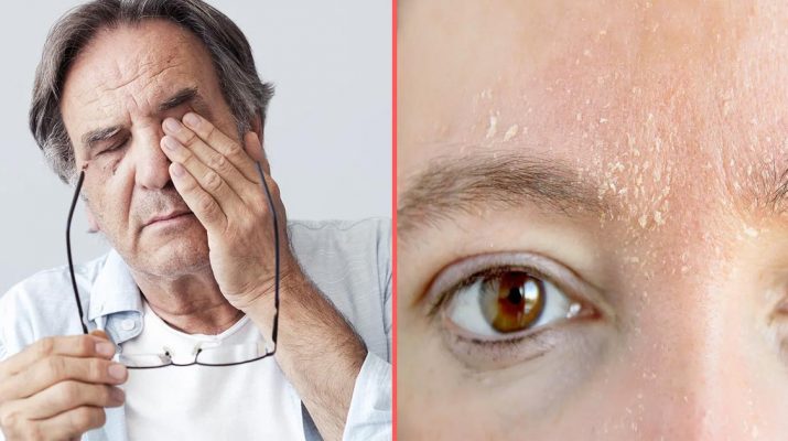 5-Hidden-Signs-You-Are-Vitamin-Deficient