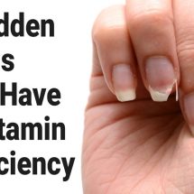 5 Hidden Signs You Have A Vitamin Deficiency