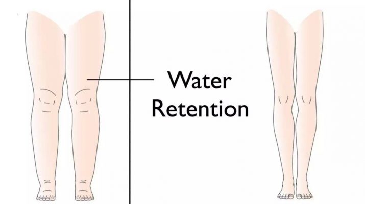 5-Reasons-Your-Body-Retains-Water-&How-to-Avoid-It