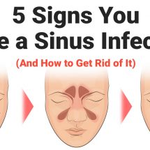 5 Signs You Have a Sinus Infection (And How to Get Rid of It)