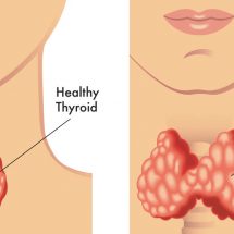 5 Things You Need To Know About Your Thyroid